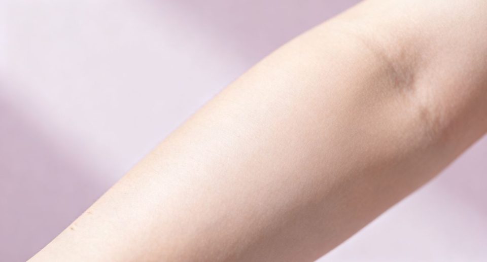 Maintaining Laser Hair Removal: Long-Term Advantage